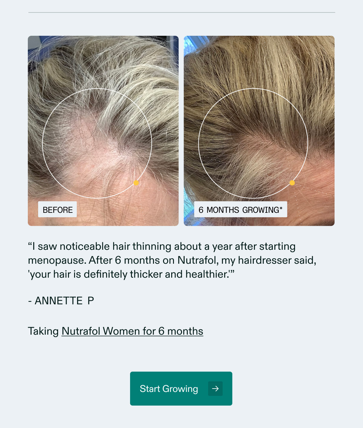“I saw noticeable hair thinning about a year after starting menopause. After 6 months on Nutrafol, my hairdresser said, 'your hair is definitely thicker and healthier.'”- ANNETTE P | Taking Nutrafol Women’s Balance for 6 months