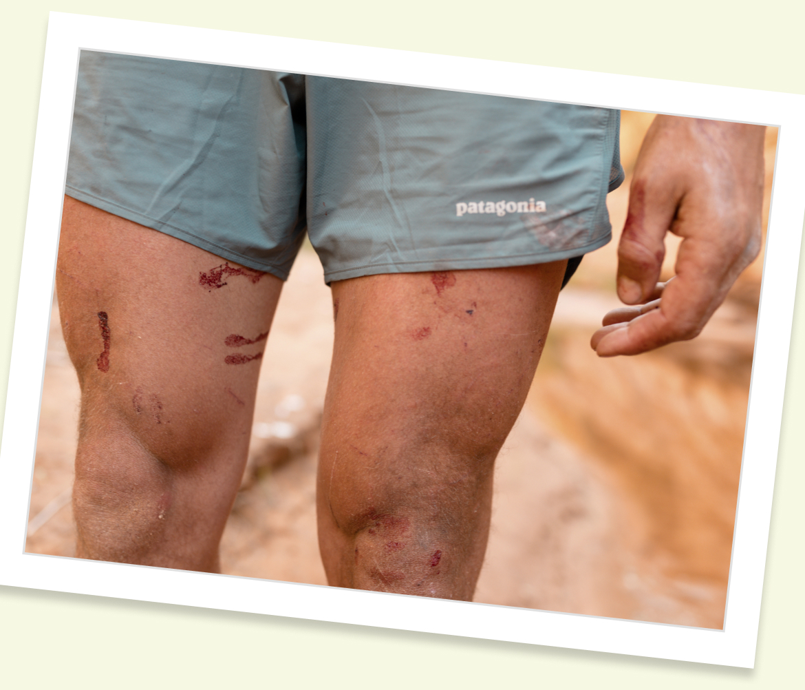 A trail runner’s legs with many scrapes and cuts from bushwhacking.
