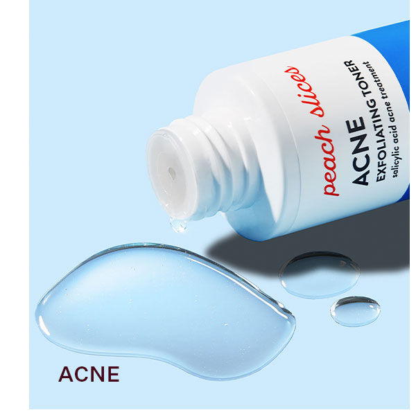 ACNE