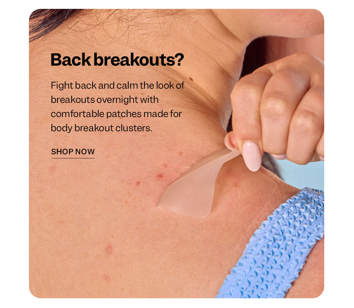 Back breakouts?  Fight back and calm the look of breakouts overnight with comfortable patches made for body breakout clusters.