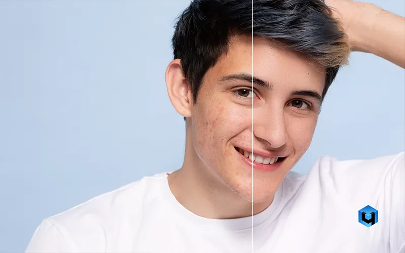 AI Retouching Plugin for Flawless Skin