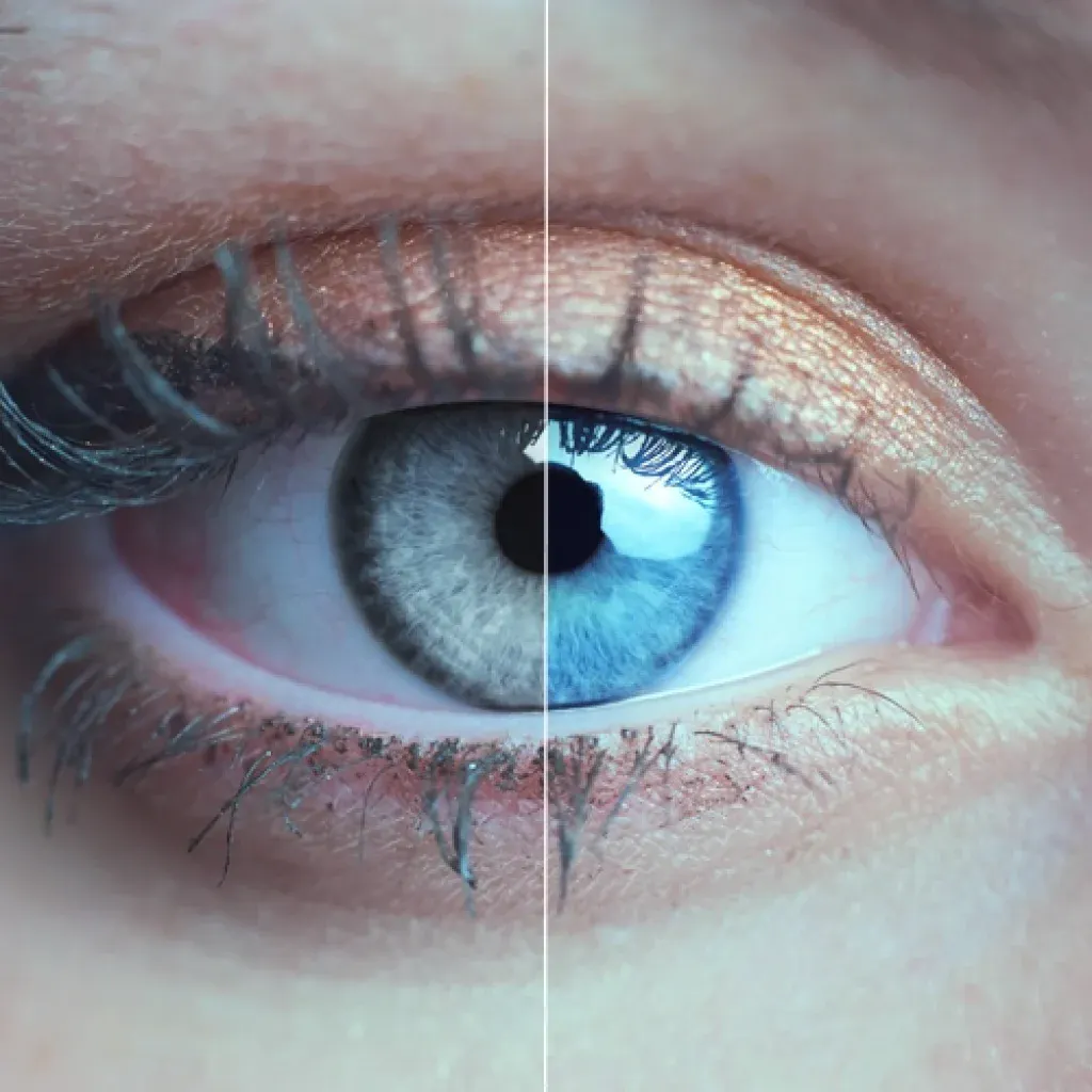 blue eye overlay