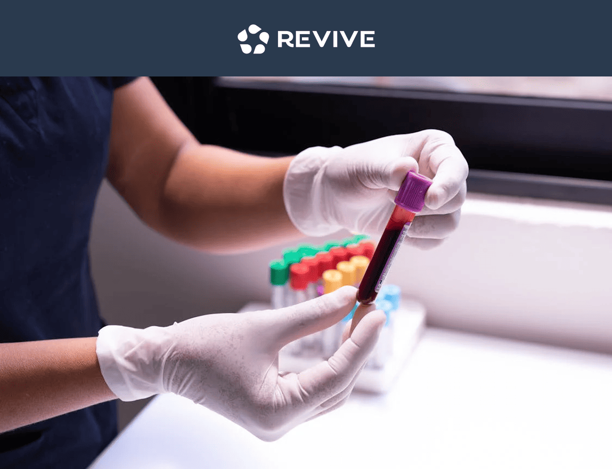 What Is GFR and What Does It Mean For Your Kidneys?