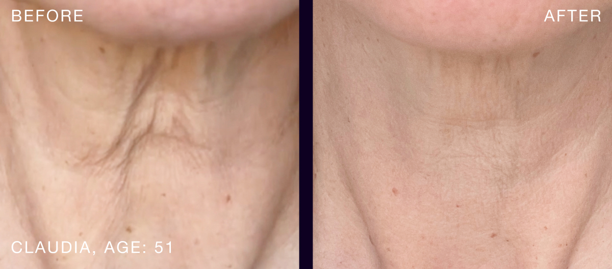 B&A