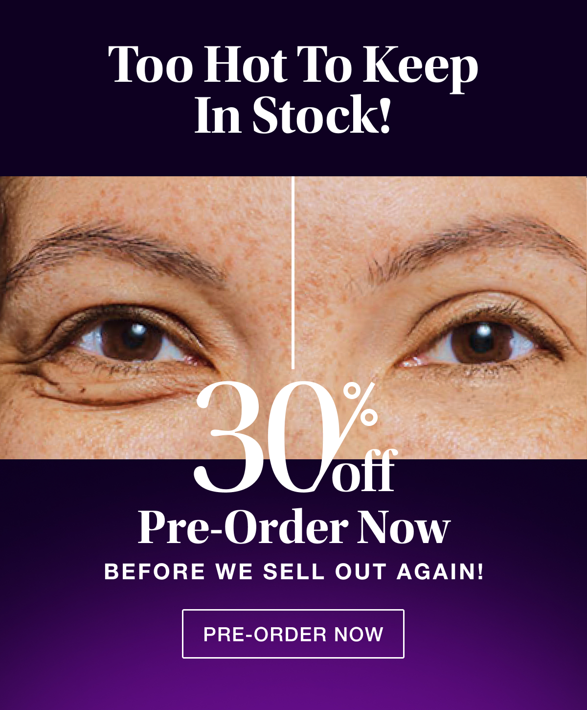 Too Hot to Keep in Stock! Pre-Order Now Before We Sell Out Again!