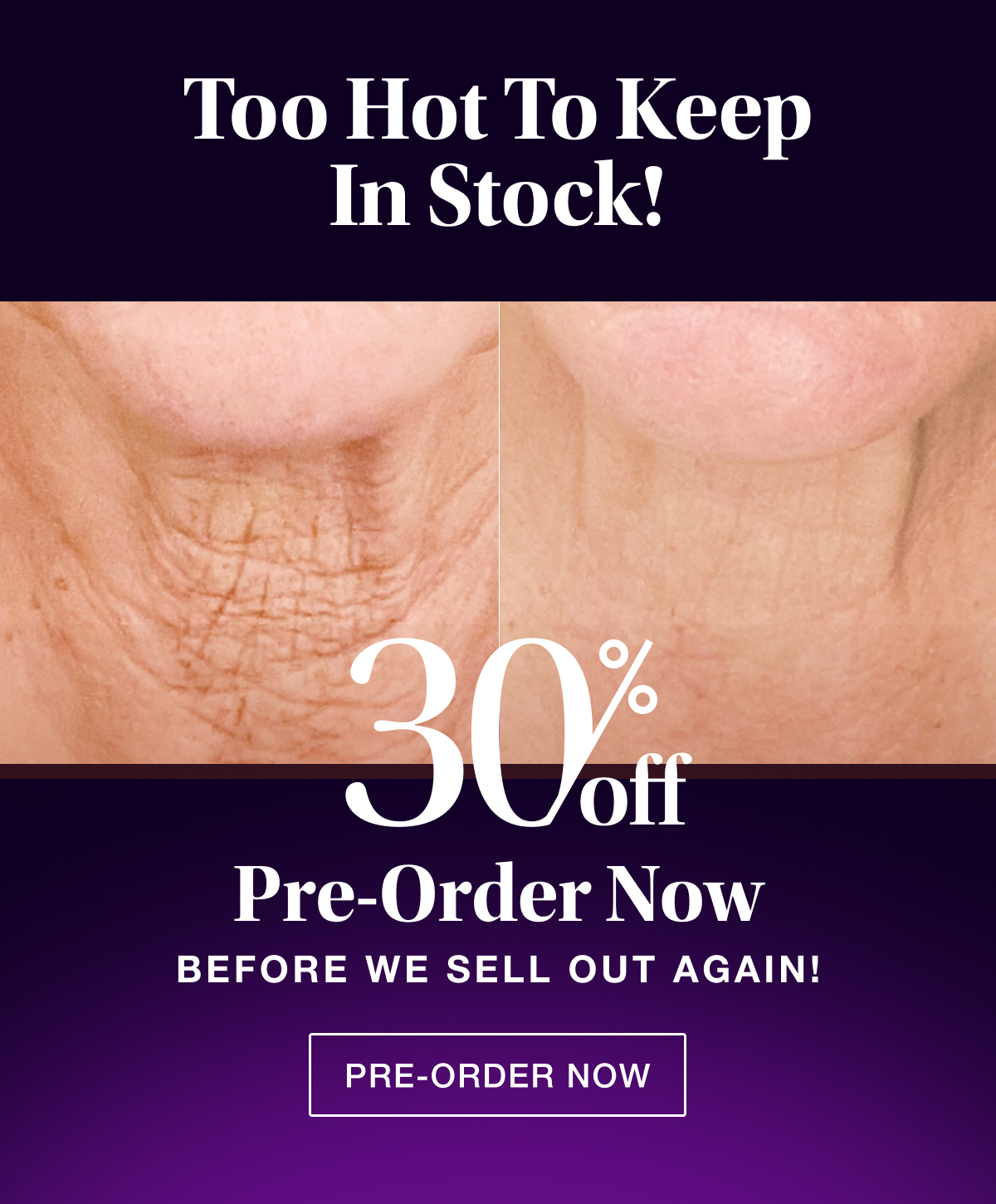 Too Hot to Keep in Stock! Pre-Order Now Before We Sell Out Again!