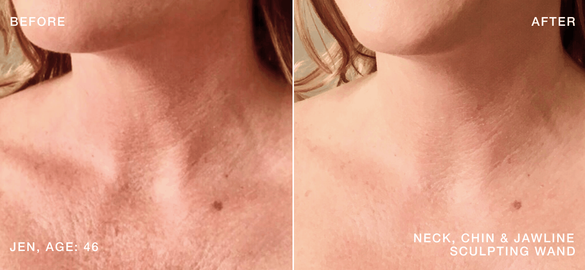 B&A