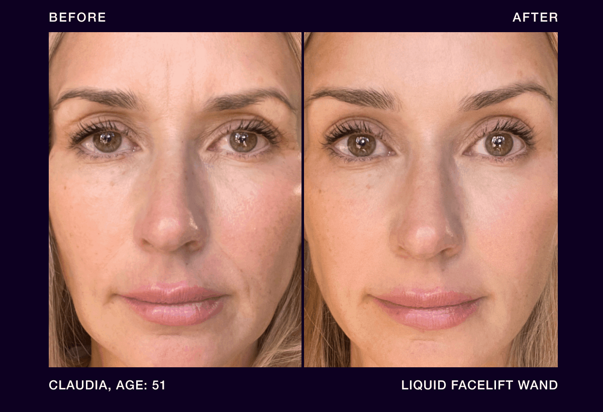 B&A
