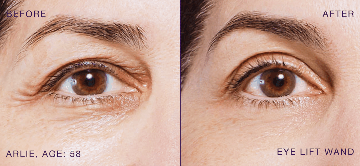 B&A