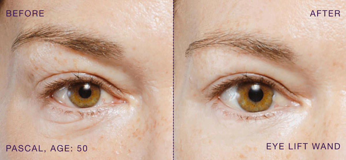 B&A