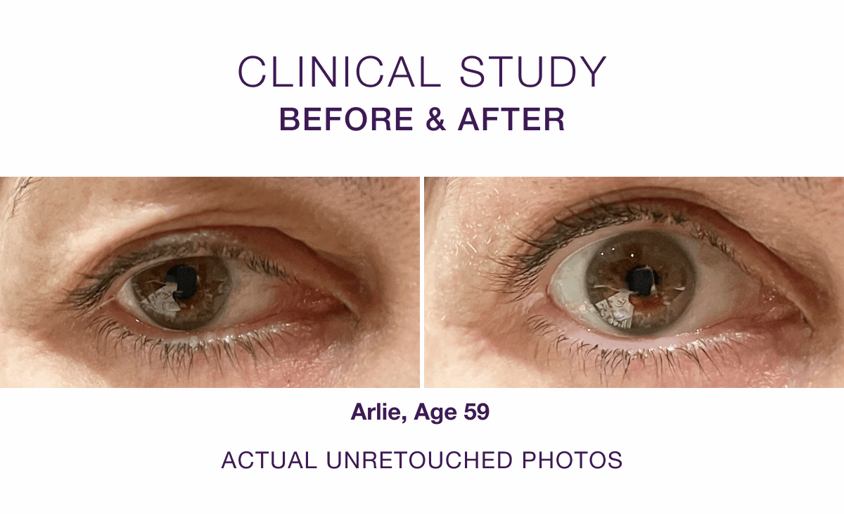 B&A