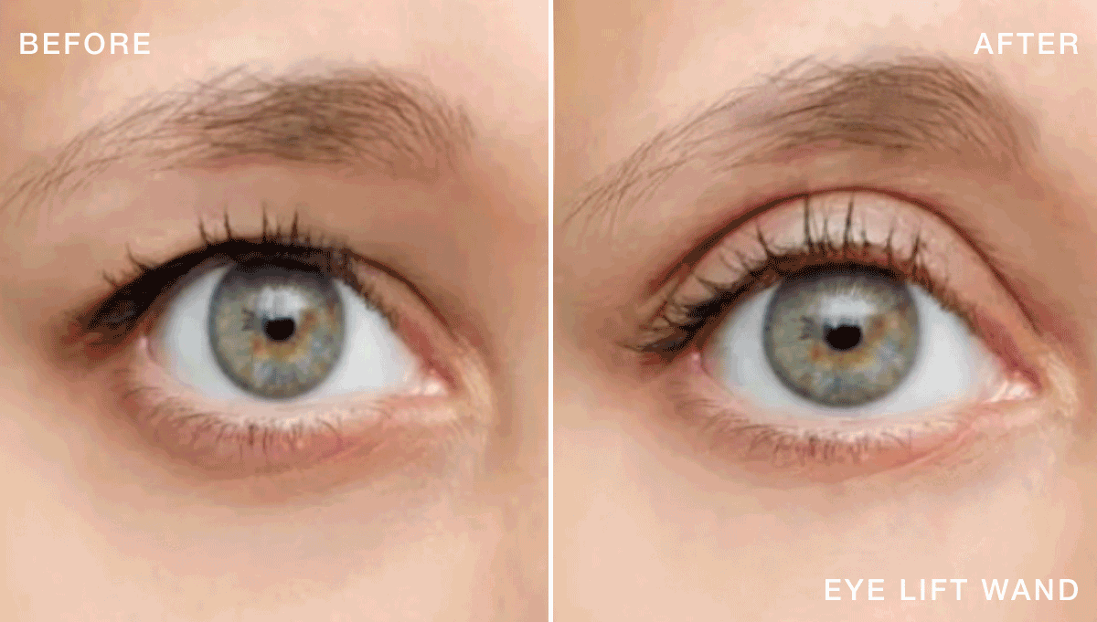 B&A