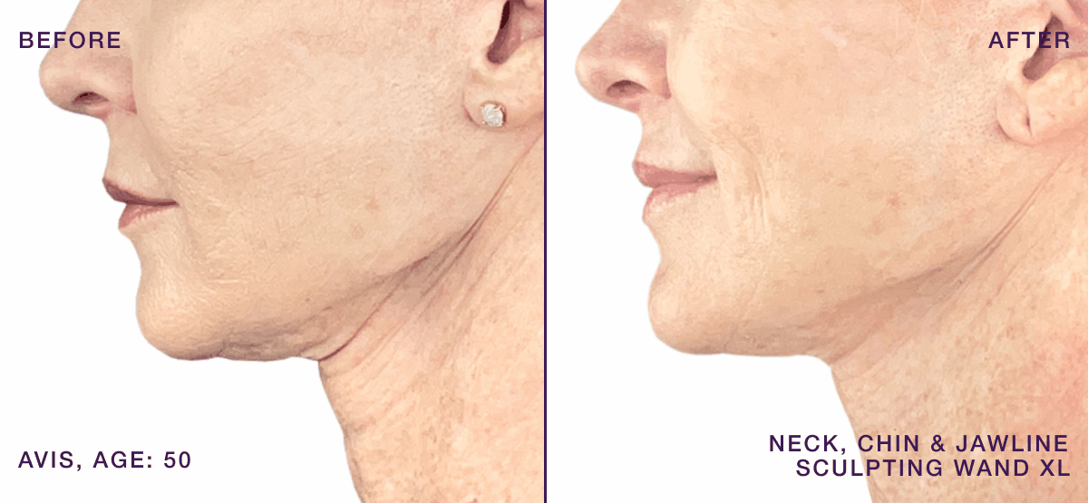 Neck Wand