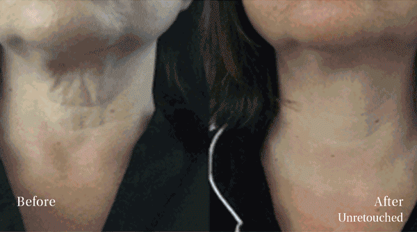 Before & After