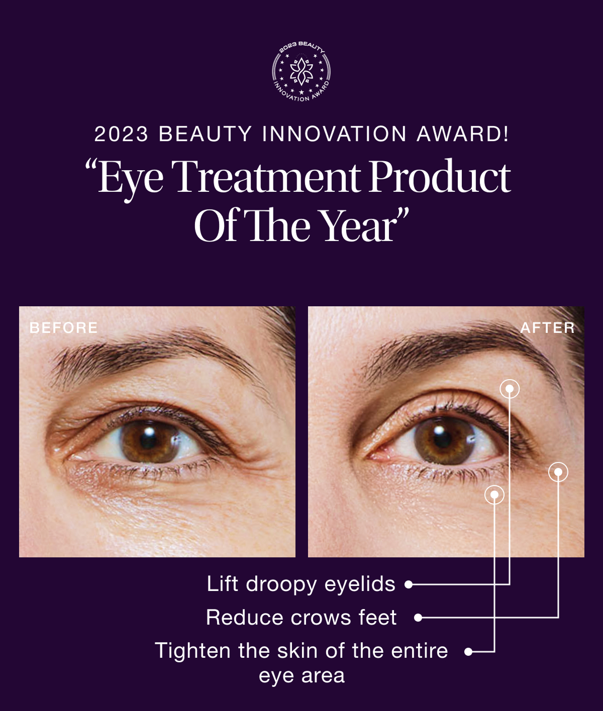 2023 BEAUTY INNOVATION AWARD!
