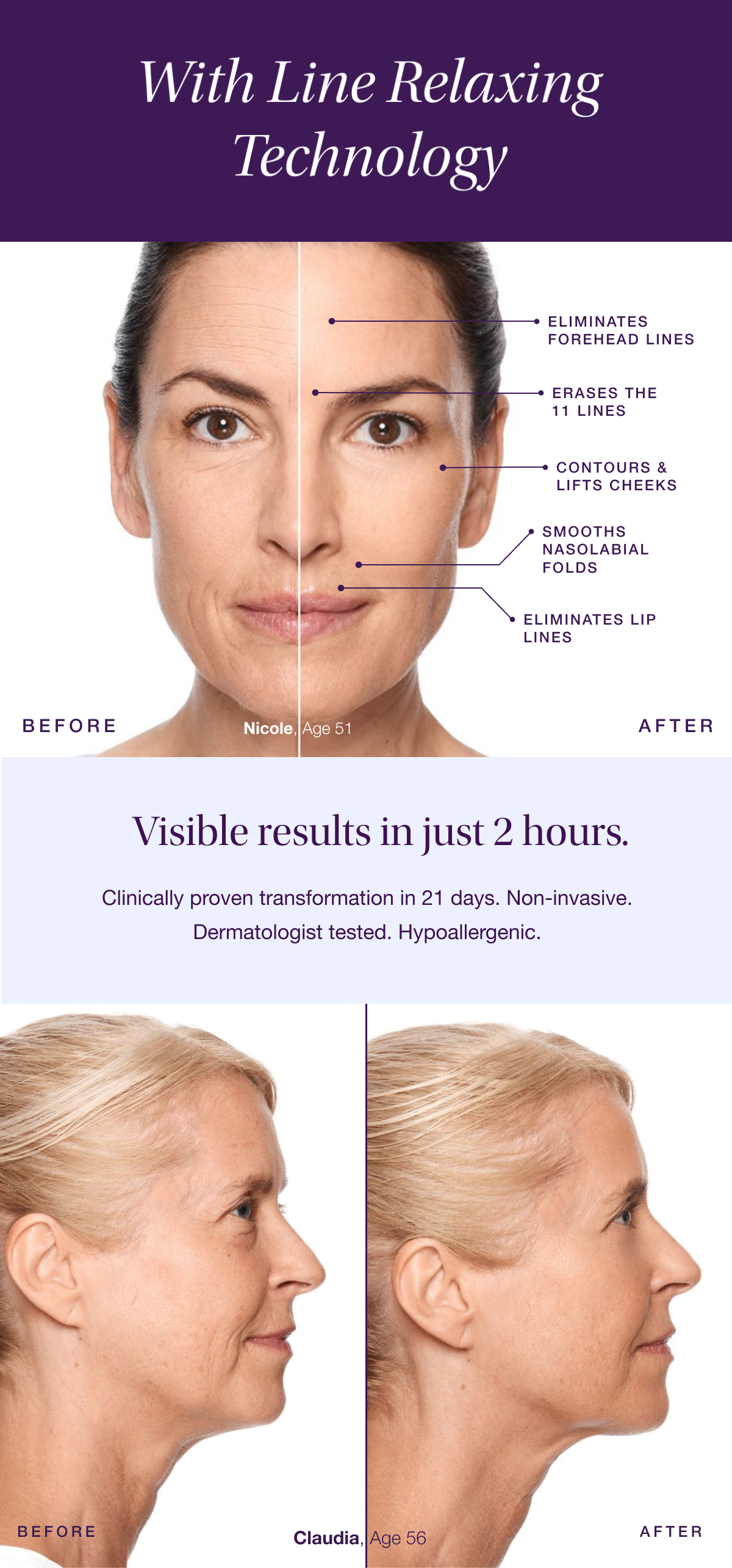 BEFORE & AFTER