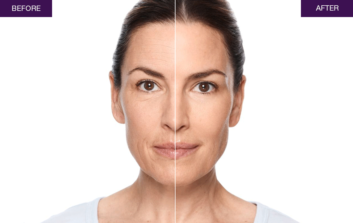 SHOP 30% OFF LIQUID FACELIFT WAND