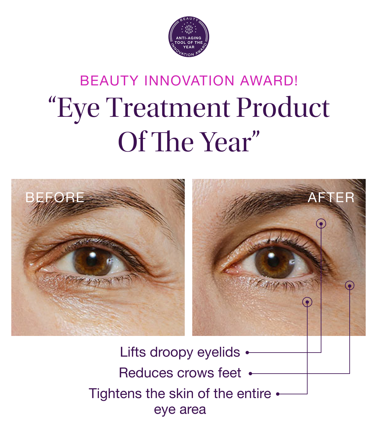 BEAUTY INNOVATION AWARD