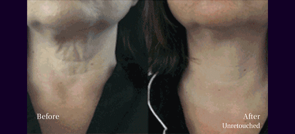 BEFORE & AFTER