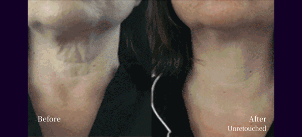 BEFORE & AFTER