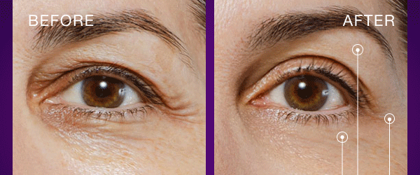 Shop 40% Off Eye Lift Wand