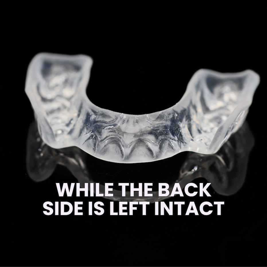 The back side of the front 6 teeth are left intact