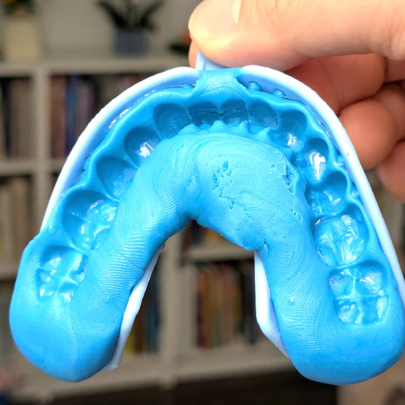 Shallow Impressions: The impression often doesn't go deep enough, especially around the back molars. This can result in a loose or unstable fit.