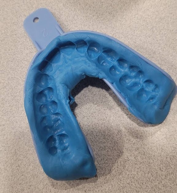 Incorrect Putty Timing: Rushing the process or waiting too long to place the tray can cause the putty to distort, leading to an inaccurate impression