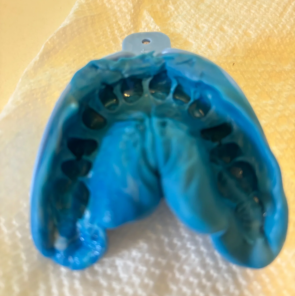 Off-Center or Uneven Impressions: Placing the tray unevenly can result in a night guard that feels imbalanced or doesn't cover all your teeth properly.
