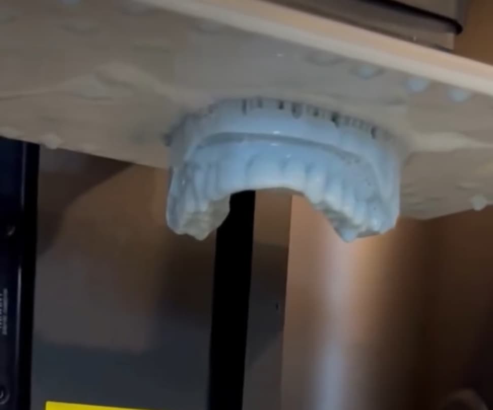 3d scanning to create a digital model for your teeth