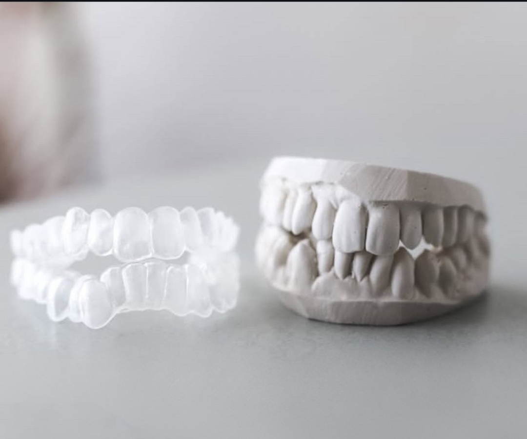 Get your perfect fit today at Sentinel Mouthguards