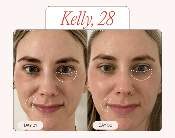 Before & After