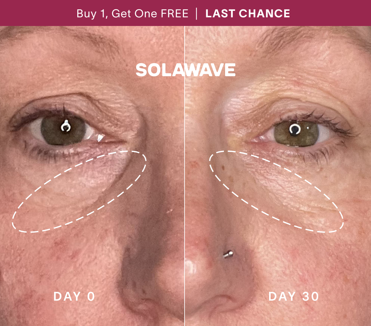 Buy 1, Get 1 Free | LAST CHANCE