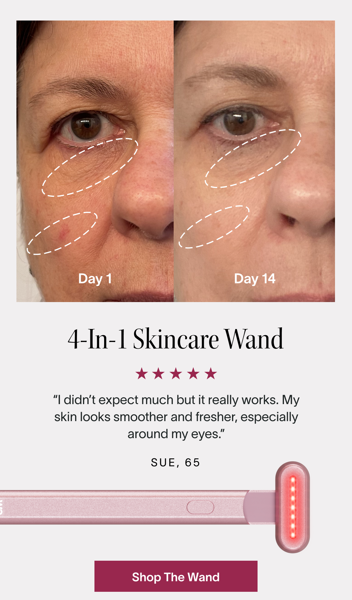 4-in-1 Skincare Wand