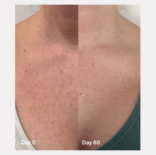 Day 0. Day 30. Day 60.