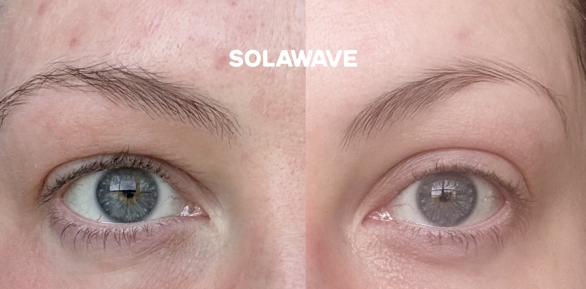 Red Light = Your Collagen Hack