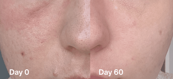 Red Light = Your Collagen Hack