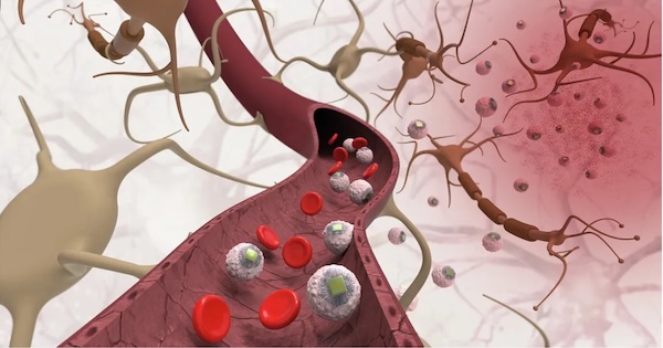 MIT invents injectable brain chips | Futurism