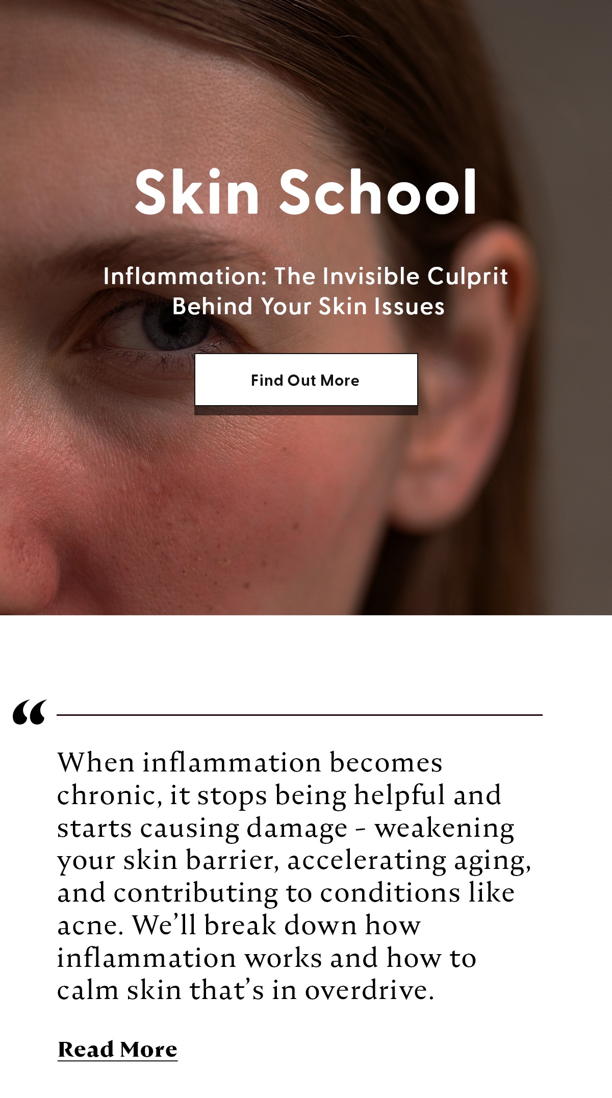 The Invisible Culprit Behind Your Skin Issues