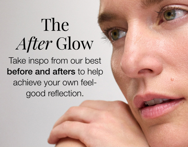 Take Inspo from Our Best Before & Afters