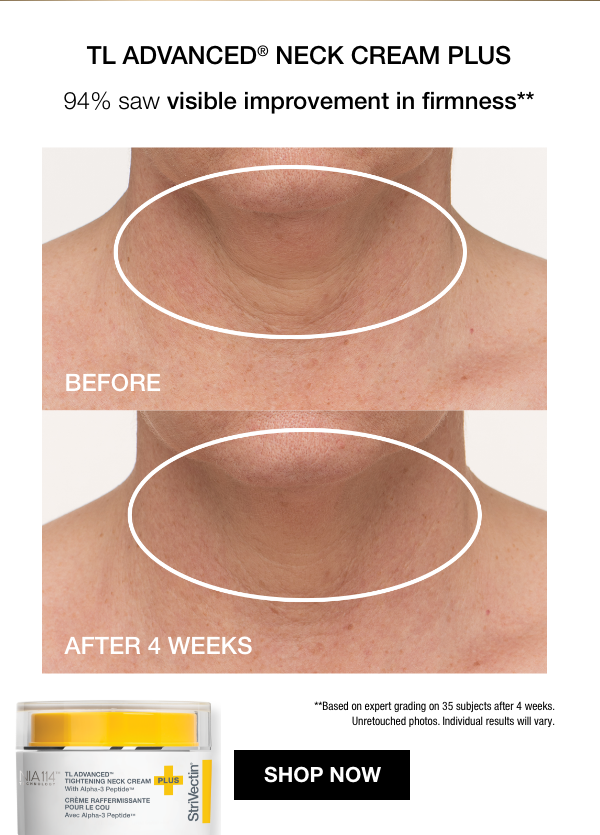 The #1 neck cream†
