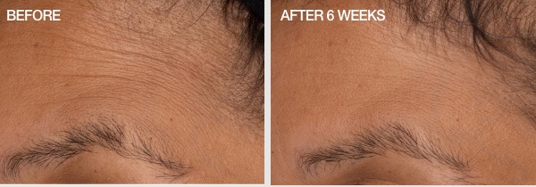 See the Results