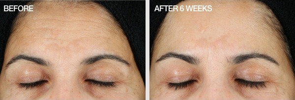 See Before & After