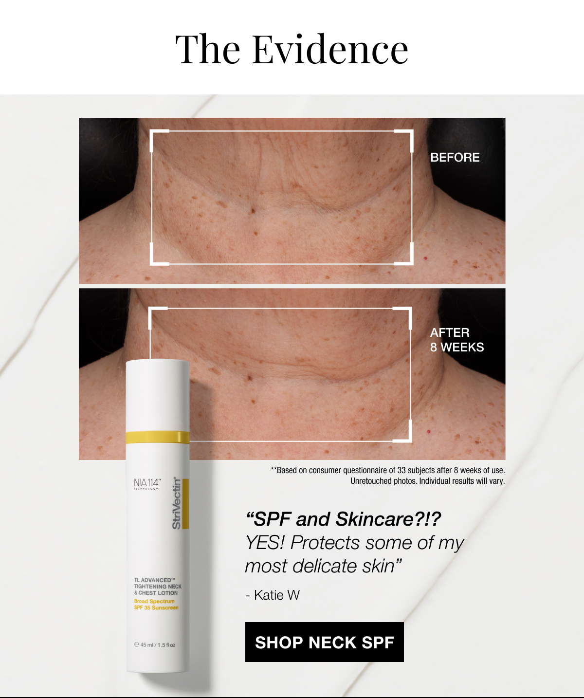 Shop TL Advanced Neck & Chest Lotion SPF 35
