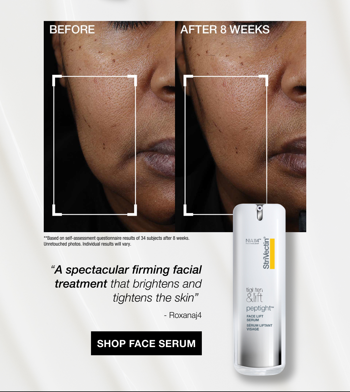 Shop Peptight® Face Lift Serum
