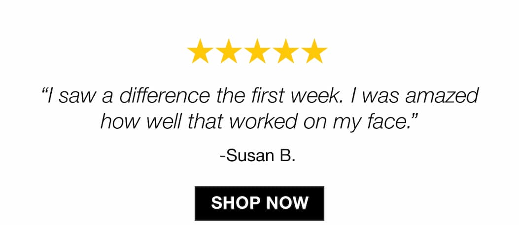 5 star review for Strivectin Peptight Face Lift Serum