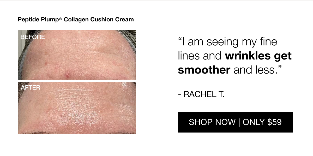 The next-gen wrinkle cream