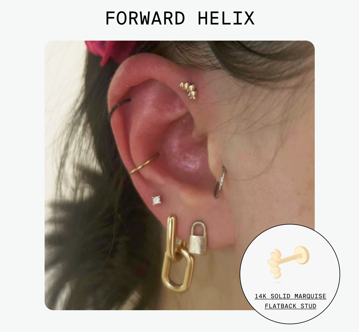 GOLD STANDARD: FORWARD HELIX