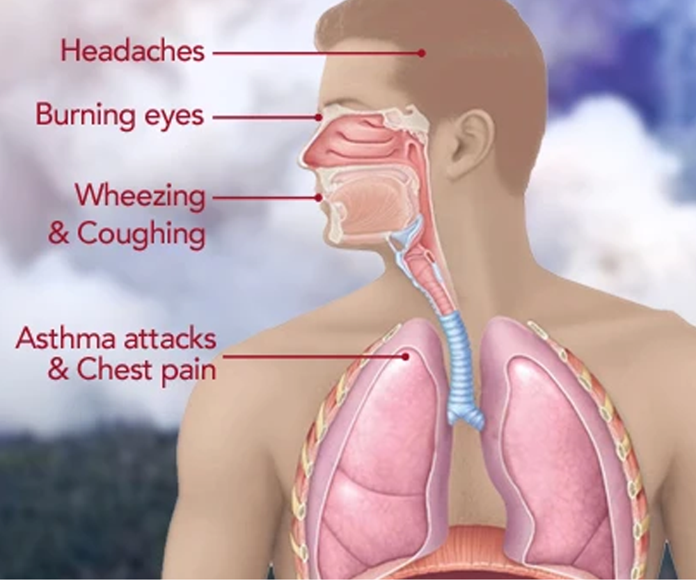 Wildfires and Long-Term Health Affects