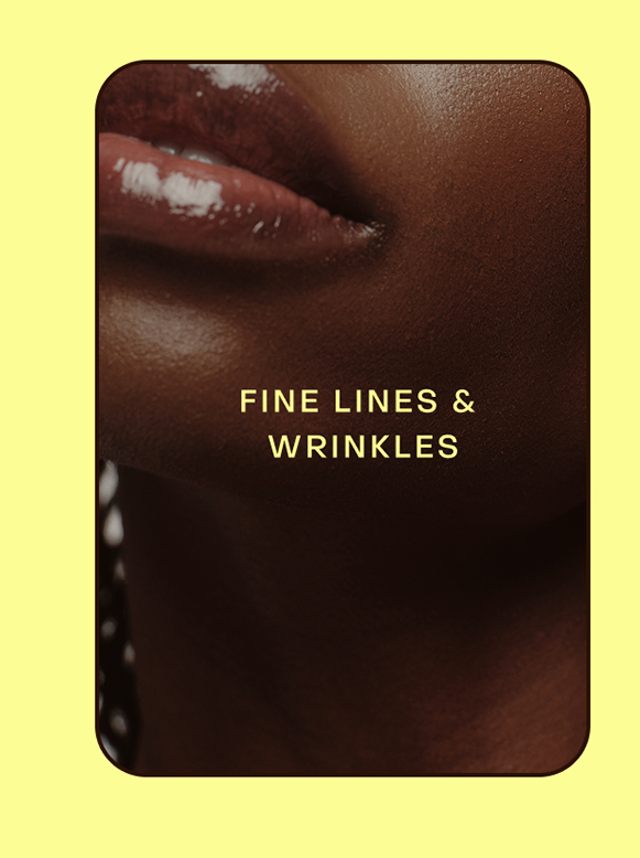 fine lines & wrinkles